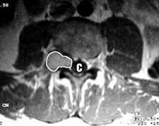 [NF2 Figure 2]