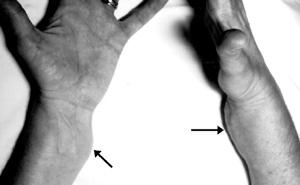 [NF2 Figure 3]