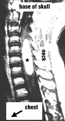 [NF2 Figure 5]